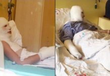 Dicle Üniversitesi’nde İki Öğrenci Yandı