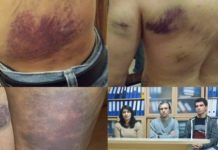 Gazi Mahallesi’nde Polis Gözaltına Aldığı Öğrenciye İşkence Etti
