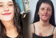 Berfin’i Yakan Sanığa Ödül Gibi Ceza: “Kasten Yaralama”dan 12 Yıl