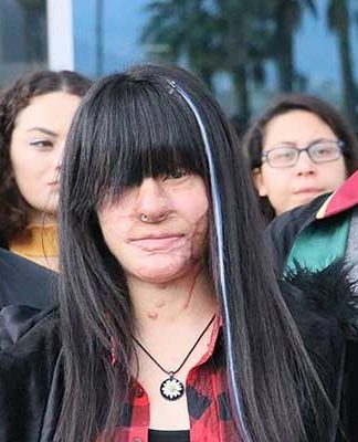 Berfin yeni çıkacak infaz yasası öncesi asitli saldırgan hakkındaki şikayetinden vazgeçti