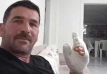 Hayvana şiddetin sınırı yok: Köpeklere atmak istediği torpil elinde patladı!