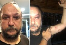BirGün gazetesi yazarı Güvenç Dağüstün saldırıya uğradı