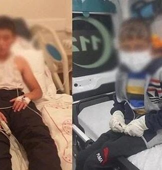 Sokak köpeği ısırması sonrası kuduz teşhisi konulan çocuk yaşamını yitirdi