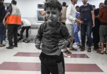 The Guardian Gazze’deki durumu yazdı: “Doktorlar anestezi olmadan ameliyat yapıyor, antiseptik olarak sirke kullanılıyor”