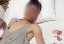 Gaziantep’te ırkçılığın geldiği son nokta: 15 yaşındaki Suriyeli çocuğa işkence ve cinsel istismar