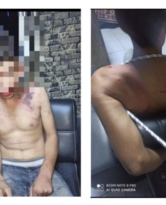 Maaşını isteyen işçiye, patronları işkence etti: “Elektrik verdiler, böcek yedirdiler”