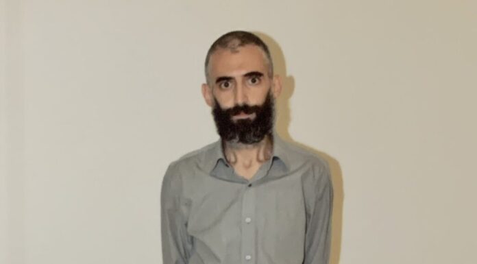Kuyu tipi hapishanelere karşı açlık grevi yapan Gürkan Türkoğlu yaşamını yitirdi